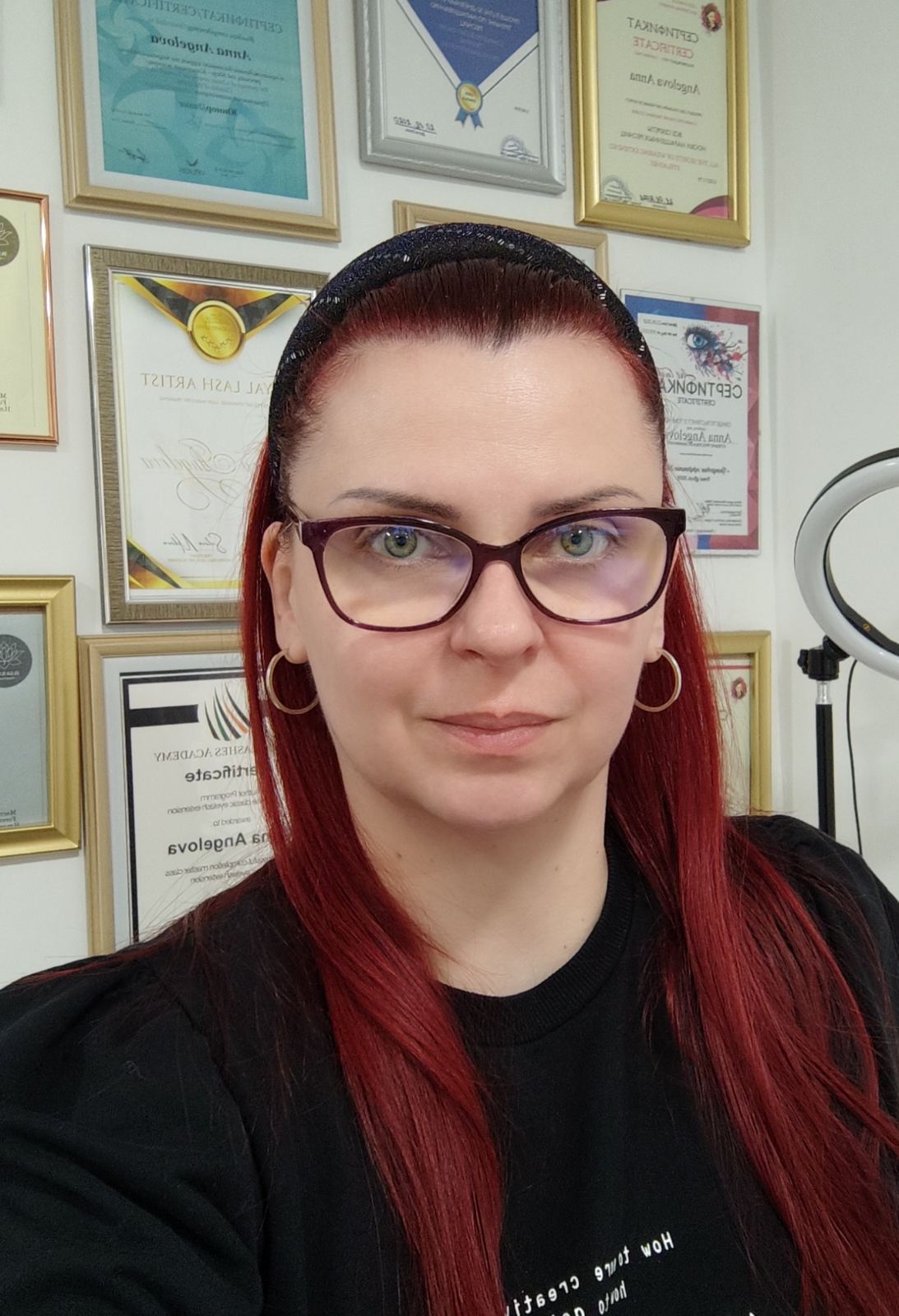 Анна Ангелова, Миглопластика и ламиниране в Сандански
